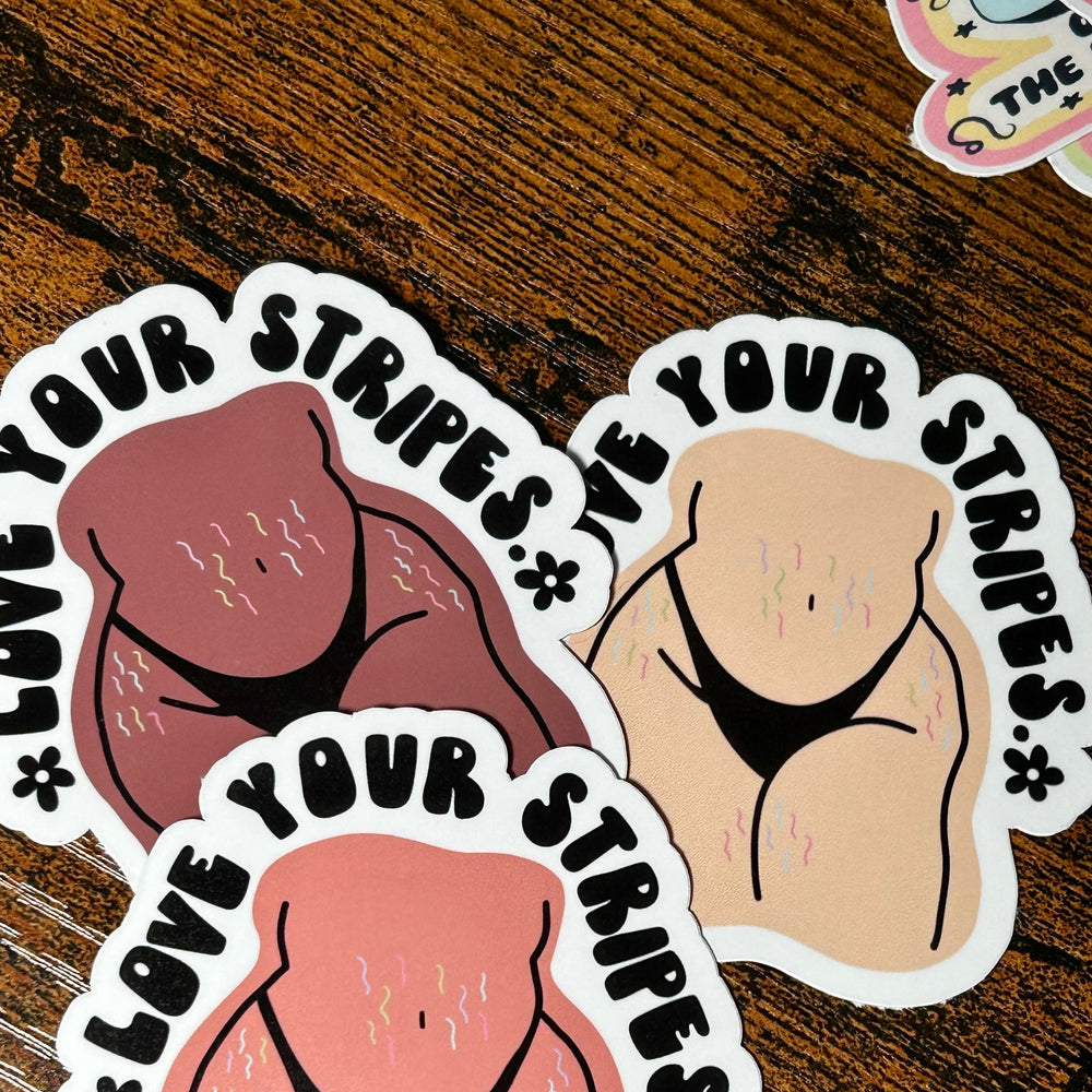 Three stickers with 'Love Your Stripes' text on a wooden surface